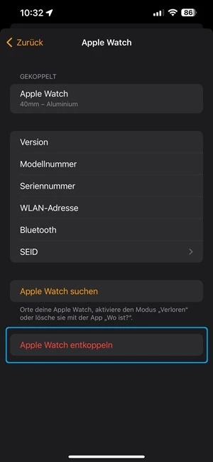 Screenshot von der App „Watch“ mit den Auswahlmöglichkeiten für eine gekoppelte Apple Watch.